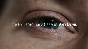 The Extraordinary Case Of Alex Lewis